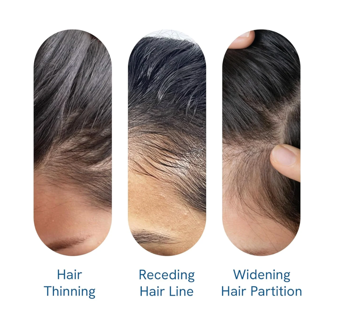 Constelle Rosemary Hair Growth Serum Roll On 25 ml | 3% Rosemary | 2% Aminexil | 3% Redensy l 2% Anagain | Precision Scalp Applicator | Paraben & Sulphate Free | Non oily and mess free